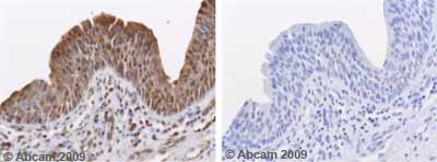 Immunohistochemistry (Formalin/PFA-fixed paraffin-embedded sections) - Anti-MMP10 antibody (AB38930)