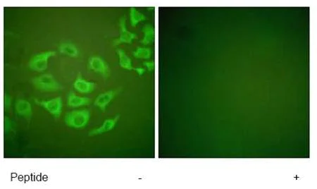 Immunocytochemistry/ Immunofluorescence - Anti-MMP10 antibody (AB59437)