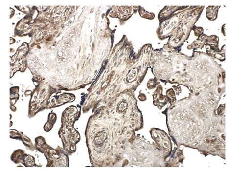 Immunohistochemistry (Formalin/PFA-fixed paraffin-embedded sections) - Anti-MMP10 antibody [MM0024-9G10] (AB56304), expandable thumbnail