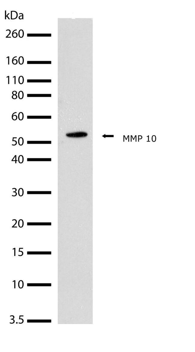Western blot - Anti-MMP10 antibody [RP23040071] (AB308056), expandable thumbnail