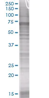 SDS-PAGE - MMP10 overexpression 293T lysate (whole cell) (AB94294)