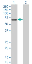 Western blot - MMP10 overexpression 293T lysate (whole cell) (AB94294)