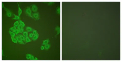 Immunocytochemistry/ Immunofluorescence - Anti-MMP11 antibody (AB119284)