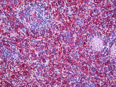 Immunohistochemistry (Formalin/PFA-fixed paraffin-embedded sections) - Anti-MMP11 antibody (AB119284)