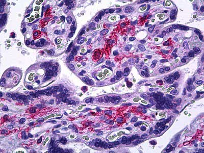 Immunohistochemistry (Formalin/PFA-fixed paraffin-embedded sections) - Anti-MMP11 antibody (AB119284)