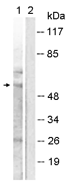 Western blot - Anti-MMP11 antibody (AB119284)