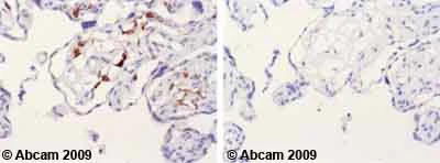 Immunohistochemistry (Formalin/PFA-fixed paraffin-embedded sections) - Anti-MMP11 antibody (AB53143)