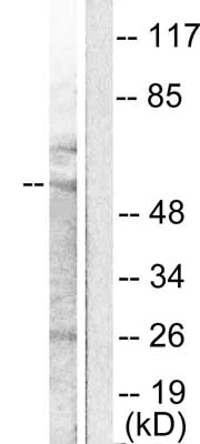 Western blot - Anti-MMP11 antibody (AB53143)