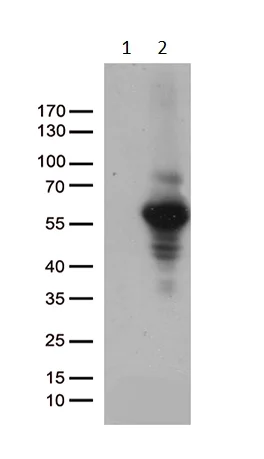 Western blot - Anti-MMP11 antibody [OTI3E10] (AB236510)
