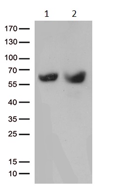 Western blot - Anti-MMP11 antibody [OTI3E10] (AB236510)