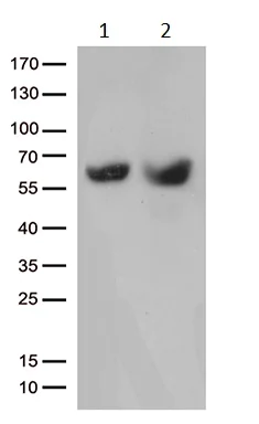 Western blot - Anti-MMP11 antibody [OTI3E10] (AB236510)