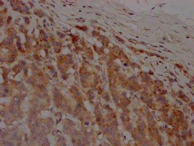 Immunohistochemistry (Formalin/PFA-fixed paraffin-embedded sections) - Anti-MMP12 antibody [2G3] (AB314017)