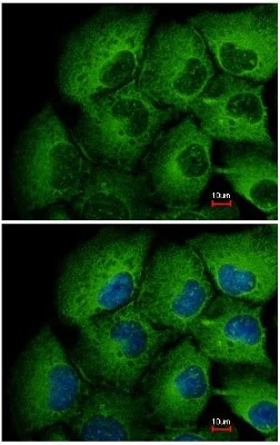 Immunocytochemistry/ Immunofluorescence - Anti-MMP12 antibody (AB137443)