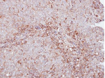 Immunohistochemistry (Formalin/PFA-fixed paraffin-embedded sections) - Anti-MMP12 antibody (AB137443)