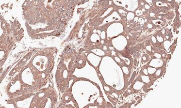 Immunohistochemistry (Formalin/PFA-fixed paraffin-embedded sections) - Anti-MMP12 antibody (AB137444), expandable thumbnail