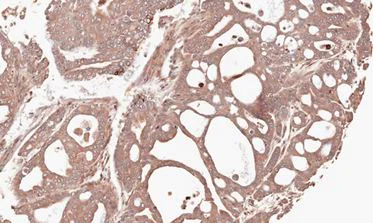 Immunohistochemistry (Formalin/PFA-fixed paraffin-embedded sections) - Anti-MMP12 antibody (AB137444)