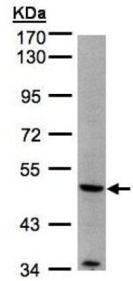 Western blot - Anti-MMP12 antibody (AB137444), expandable thumbnail