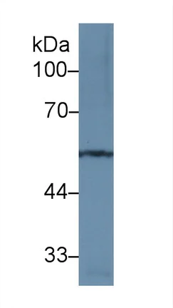 Western blot - Anti-MMP12 antibody (AB231096)