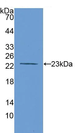 Western blot - Anti-MMP12 antibody (AB231096)