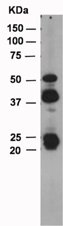 Western blot - Anti-MMP12 antibody [EP1261Y] (AB52897)