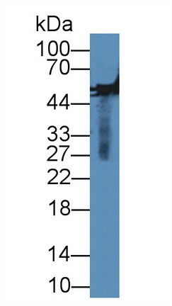 Western blot - Anti-MMP13 antibody (AB231217), expandable thumbnail