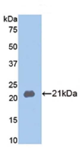 Western blot - Anti-MMP13 antibody (AB231217), expandable thumbnail