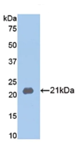 Western blot - Anti-MMP13 antibody (AB231217)