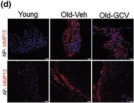 Immunohistochemistry (Frozen sections) - Anti-MMP13 antibody (AB39012)
