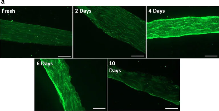 Immunohistochemistry (Frozen sections) - Anti-MMP13 antibody (AB39012)
