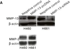 Western blot - Anti-MMP13 antibody (AB39012)