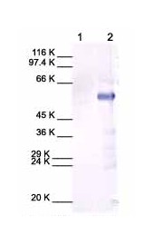 Western blot - Anti-MMP13 antibody (AB39012), expandable thumbnail