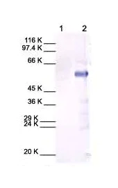 Western blot - Anti-MMP13 antibody (AB39012)