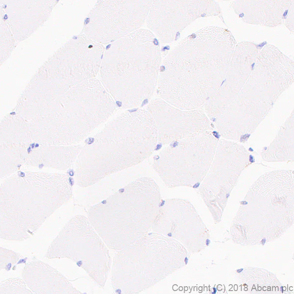 Immunohistochemistry (Formalin/PFA-fixed paraffin-embedded sections) - Anti-MMP13 antibody [EPR21778] (AB219620)