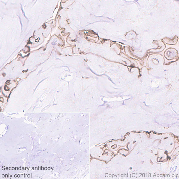 Immunohistochemistry (Formalin/PFA-fixed paraffin-embedded sections) - Anti-MMP13 antibody [EPR21778] (AB219620)