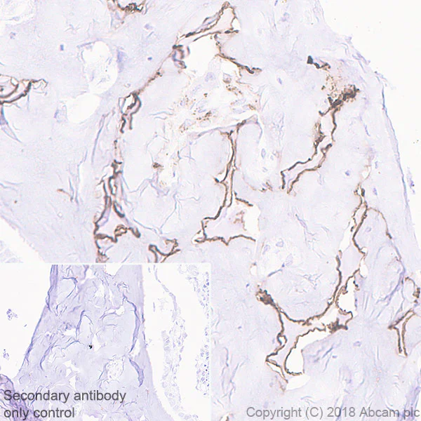 Immunohistochemistry (Formalin/PFA-fixed paraffin-embedded sections) - Anti-MMP13 antibody [EPR21778] (AB219620)