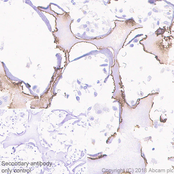 Immunohistochemistry (Formalin/PFA-fixed paraffin-embedded sections) - Anti-MMP13 antibody [EPR21778] (AB219620)