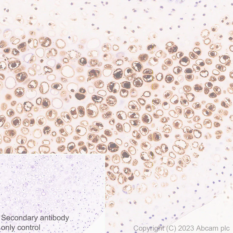 Immunohistochemistry (Formalin/PFA-fixed paraffin-embedded sections) - Anti-MMP13 antibody [EPR25858-87] - BSA and Azide free (AB315268)