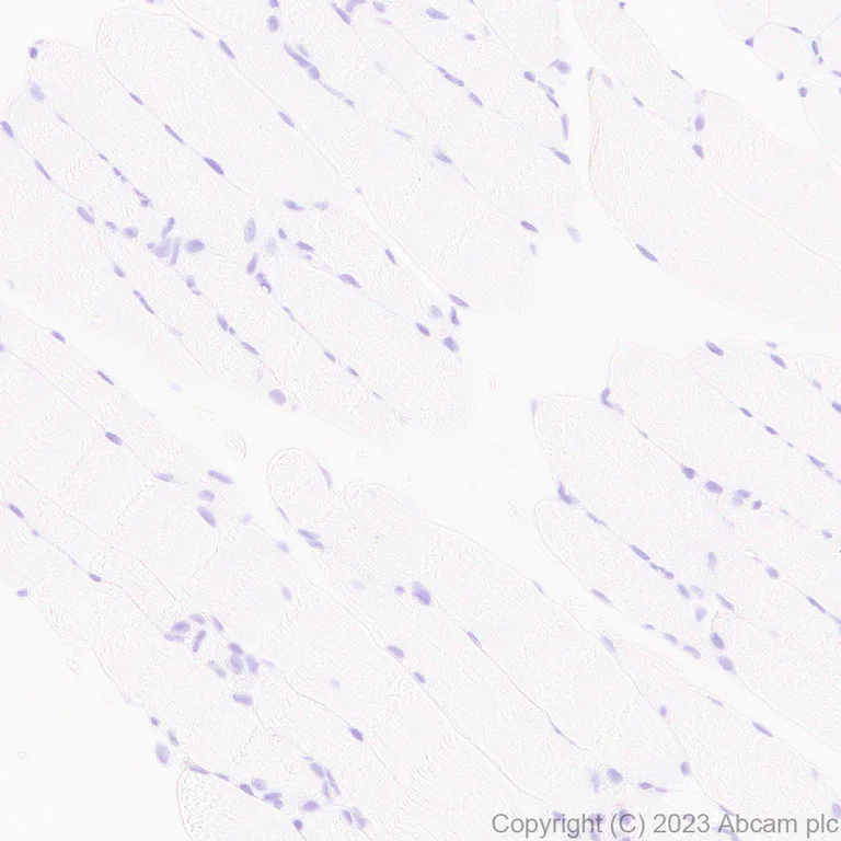 Immunohistochemistry (Formalin/PFA-fixed paraffin-embedded sections) - Anti-MMP13 antibody [EPR25858-87] - BSA and Azide free (AB315268)