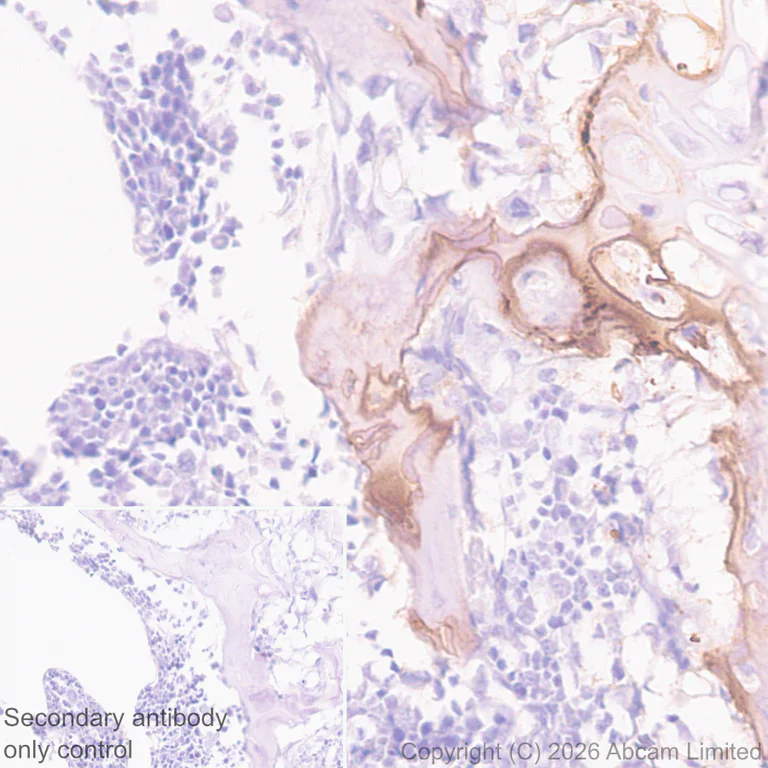 Immunohistochemistry (Formalin/PFA-fixed paraffin-embedded sections) - Anti-MMP13 antibody [EPR26103-33] (AB327346)