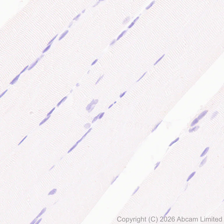 Immunohistochemistry (Formalin/PFA-fixed paraffin-embedded sections) - Anti-MMP13 antibody [EPR26103-33] (AB327346)