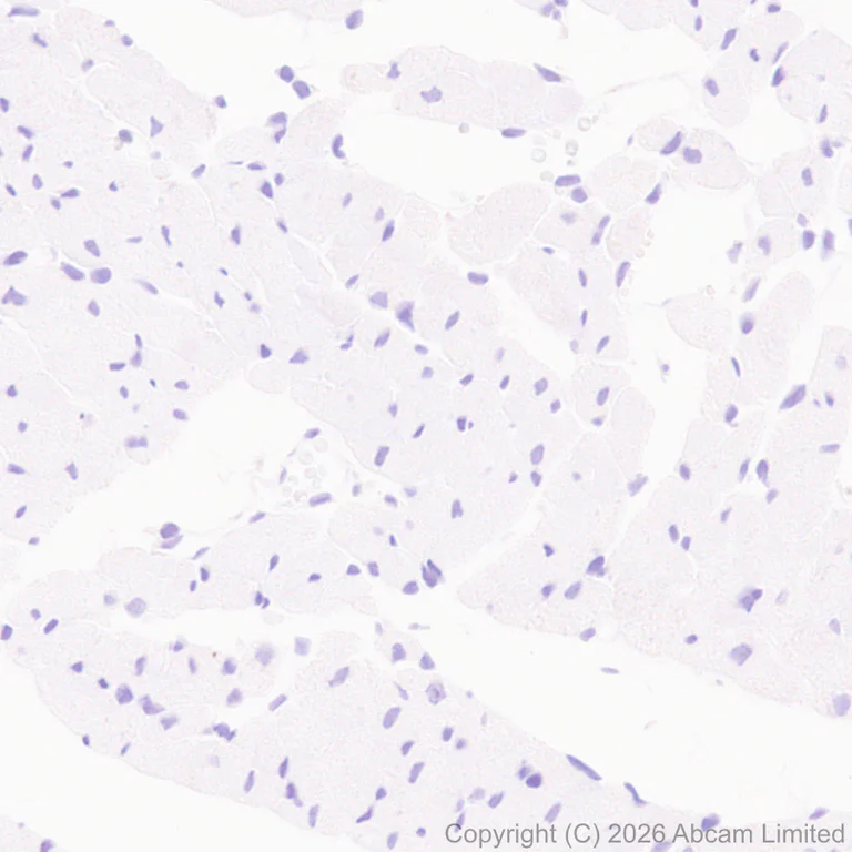Immunohistochemistry (Formalin/PFA-fixed paraffin-embedded sections) - Anti-MMP13 antibody [EPR26103-33] (AB327346)