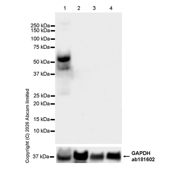 Western blot - Anti-MMP13 antibody [EPR26103-33] (AB327346)
