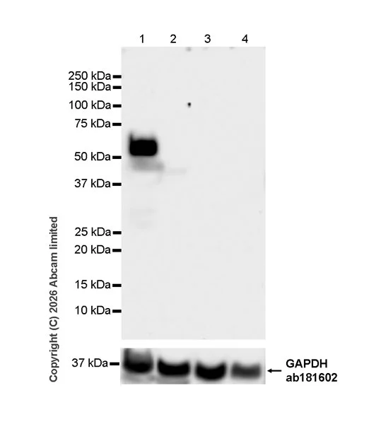 Western blot - Anti-MMP13 antibody [EPR26103-33] (AB327346)