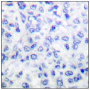 Immunohistochemistry (Formalin/PFA-fixed paraffin-embedded sections) - Anti-MMP14 antibody (AB53712), expandable thumbnail