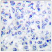 Immunohistochemistry (Formalin/PFA-fixed paraffin-embedded sections) - Anti-MMP14 antibody (AB53712)