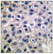 Immunohistochemistry (Formalin/PFA-fixed paraffin-embedded sections) - Anti-MMP14 antibody (AB53712)