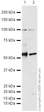 Western blot - Anti-MMP14 antibody (AB53712), expandable thumbnail