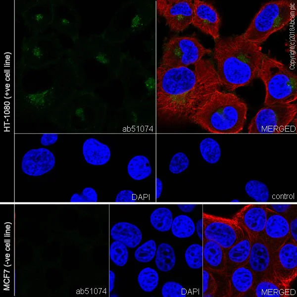 Immunocytochemistry/ Immunofluorescence - Anti-MMP14 antibody [EP1264Y] (AB51074)