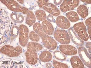 Immunohistochemistry (Formalin/PFA-fixed paraffin-embedded sections) - Anti-MMP14 antibody [EP1264Y] (AB51074)