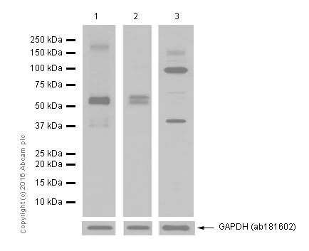 Western blot - Anti-MMP14 antibody [EP1264Y] (AB51074)